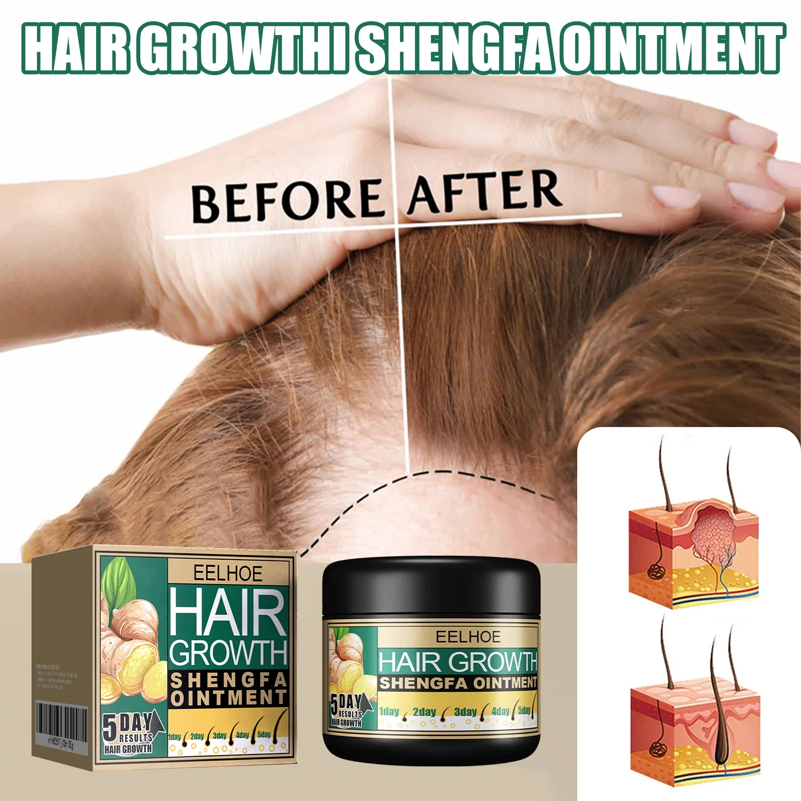 EELHOE Ginger Dense Hair Cream – Plant Growth Regulator Bewertung und Preis